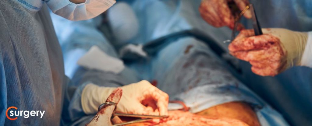 ניתוח בקע מפשעתי בילדים - בקע כלוא מול בקע רגיל, איך מזהים סכנה מיידית